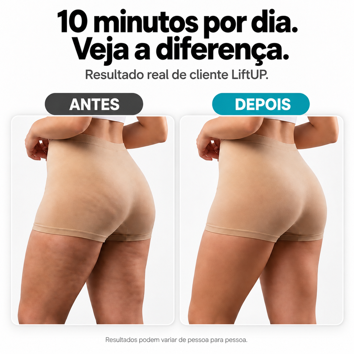 LiftUP — Massageador Corporal para Celulite e Lipedema