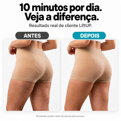 LiftUP — Massageador Corporal para Celulite e Lipedema